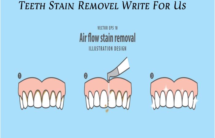 Teeth Stain Remover Write For Us