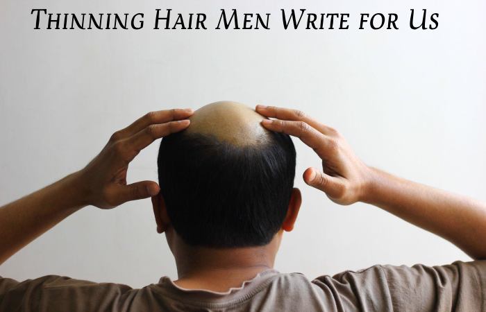Thinning Hair men write for us (2)