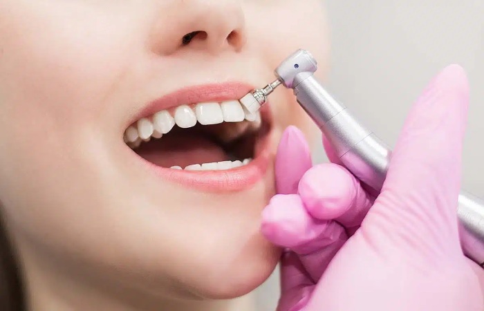 Teeth Stain Remover Write For Us