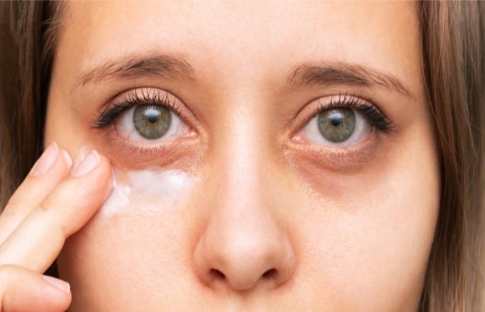 Under Eye Bags Write For Us (1)