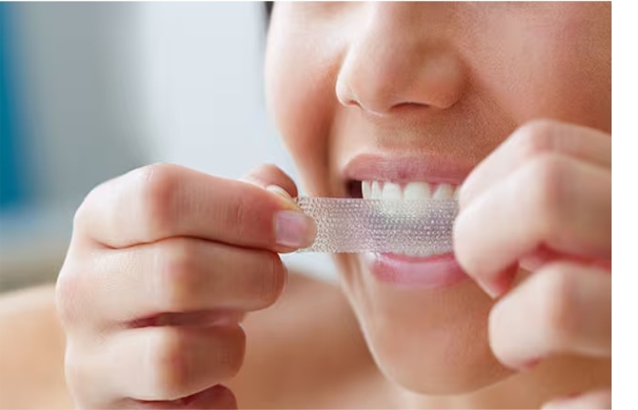 Whitening Strips